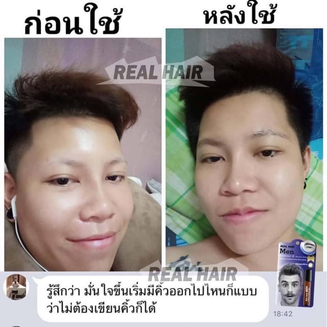 Real Hair- เซรั่มปลูกผม คิ้ว หนวด จอน - ใช้ได้ทั้ง ช ญ รูปที่ 8