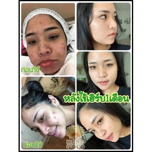 HERB Gold ครีมเฮิร์บ โกลด์ ชุด ครีม 30กรัม+ สบู่ 50 กรัม รูปที่ 4