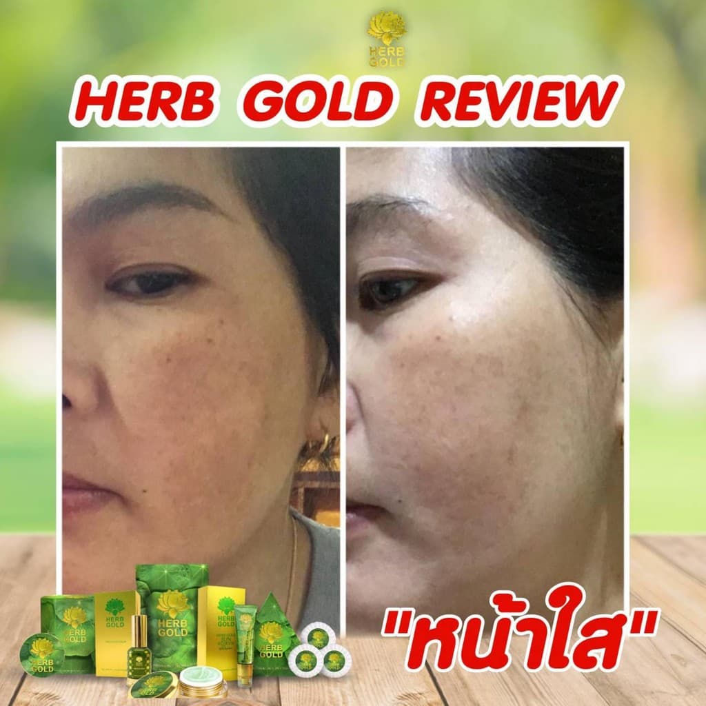 HERB Gold ครีมเฮิร์บ โกลด์ ชุด ครีม 30กรัม+ สบู่ 50 กรัม รูปที่ 2