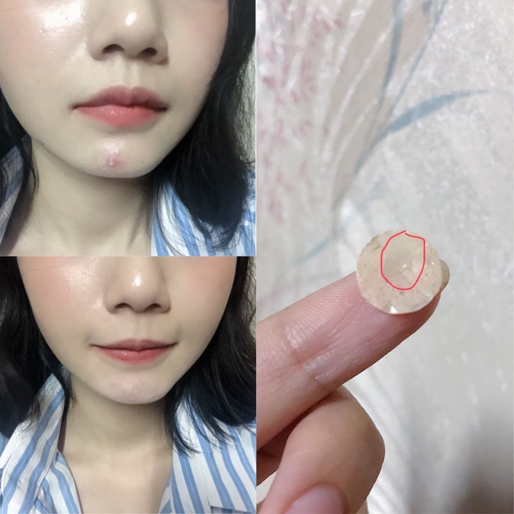 Duo DermaAngel Day 24 ชิ้น + กลางคืน 12 ชิ้น 2 กล่อง รูปที่ 7