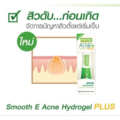 Smooth E Acne Hydrogel plus Acne-5 Rapid Action Sensitive 4% 0%steroid #768 รูปที่ 4