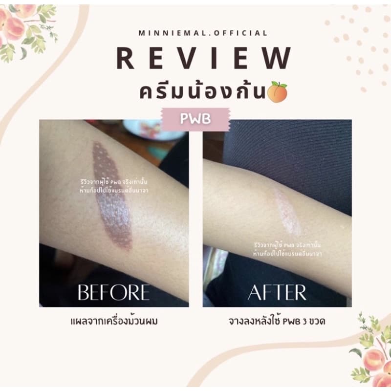ของแท้ มีบัตรตท. ครีมทาก้น PWB แพ็คเกจใหม่ New ไม่ระบุชื่อสินค้า กุ้นลาย ผดสิ้วว รอยแตกลาย ดำด้าน รูปที่ 6