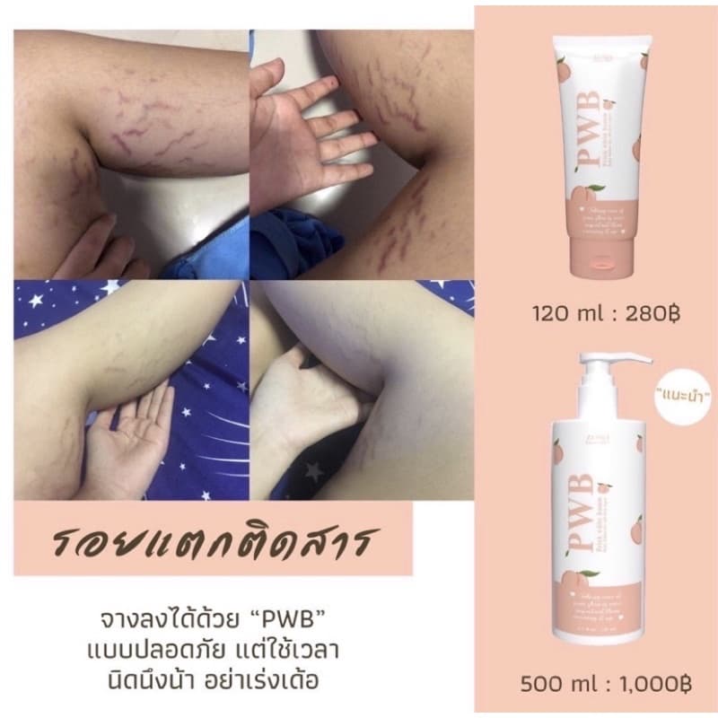 ของแท้ มีบัตรตท. ครีมทาก้น PWB แพ็คเกจใหม่ New ไม่ระบุชื่อสินค้า กุ้นลาย ผดสิ้วว รอยแตกลาย ดำด้าน รูปที่ 5