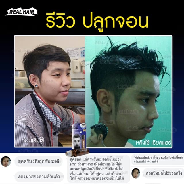 Real Hair- เซรั่มปลูกผม คิ้ว หนวด จอน - ใช้ได้ทั้ง ช ญ รูปที่ 9