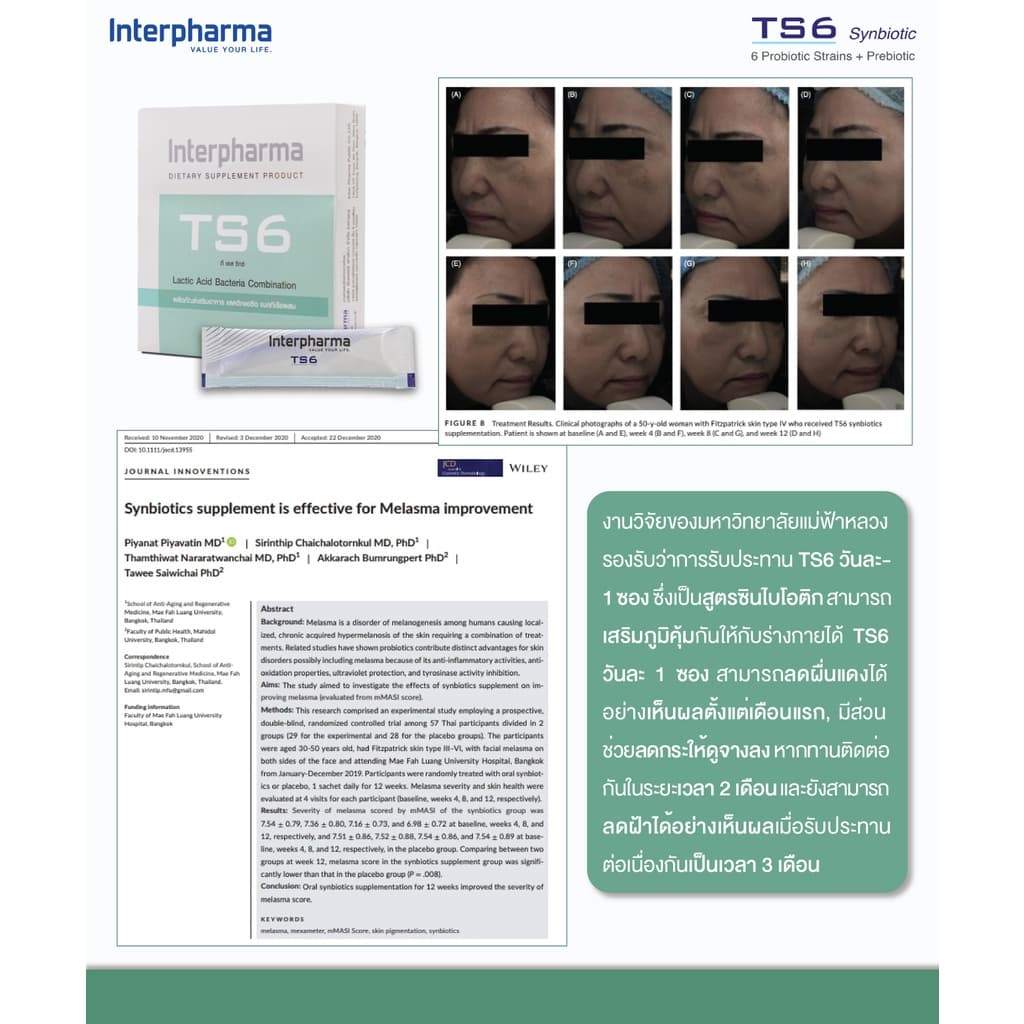 TS6 Probiotics by Interpharma อาหารเสริมช่วยรักษาฝ้า-กระ เสริมระบบขับถ่ายโดย Interpharma รูปที่ 4