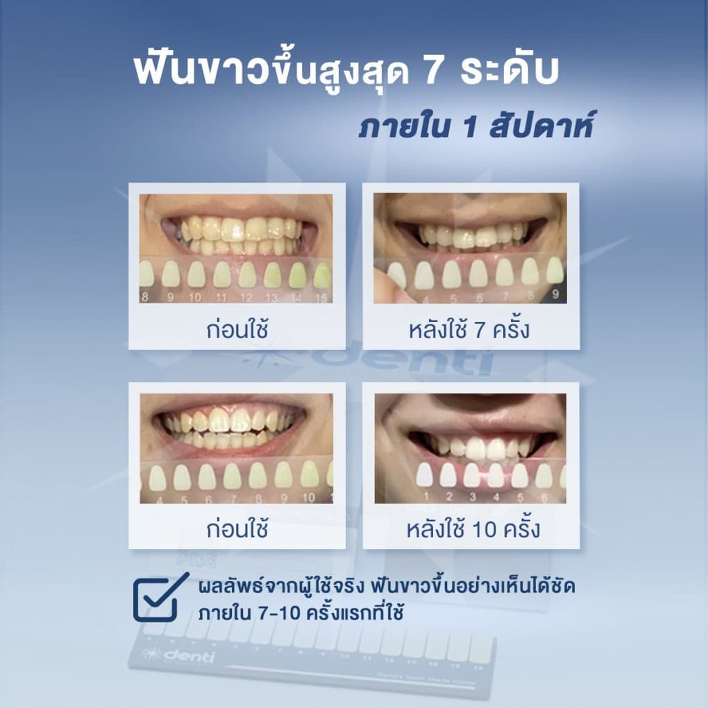 ชุดฟอกฟันขาวเดนติ Denti Teeth Whitening Set รูปที่ 4