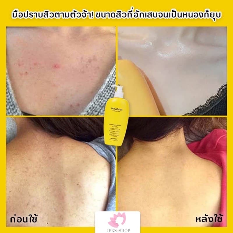 exp.2028โลชั่นลดสิว ผิวเปลือกส้ม Medi-Peel Vitamin Body Lotion รูปที่ 6