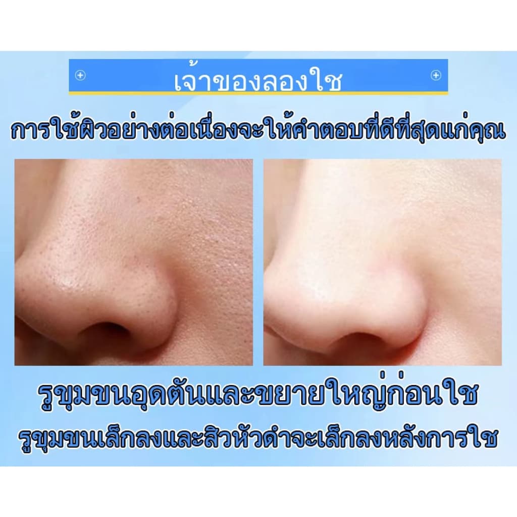 ภายใน7วัน รูขุมขนกระชับขึ้น รูขุมขนกระชับ เซรั่มหน้าใส น้ำตบกระชับรูขุมขน น้ำตบ เซรั่มหน้าใส บำรุงผิวหน้า ไวท์เทนนิ่ง เ รูปที่ 8