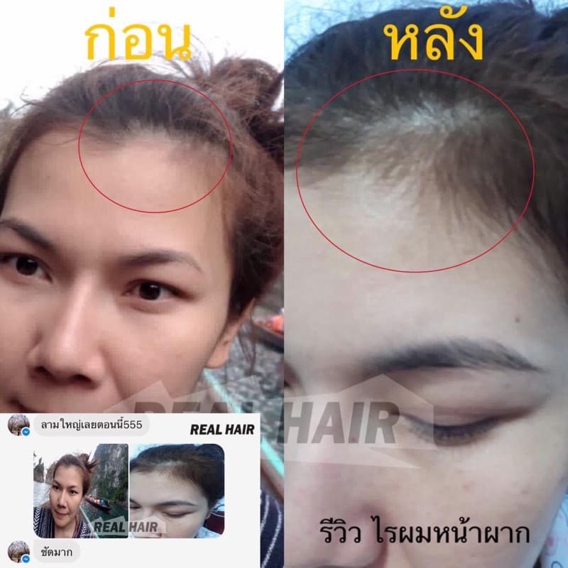 Real Hair- เซรั่มปลูกผม คิ้ว หนวด จอน - ใช้ได้ทั้ง ช ญ รูปที่ 4