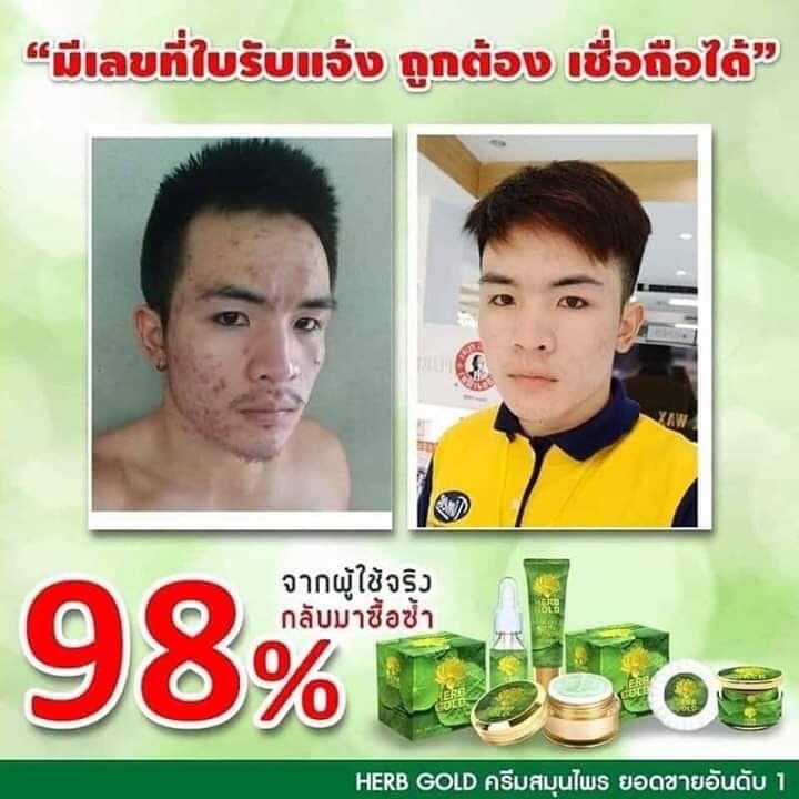 HERB Gold ครีมเฮิร์บ โกลด์ ชุด ครีม 30กรัม+ สบู่ 50 กรัม รูปที่ 7