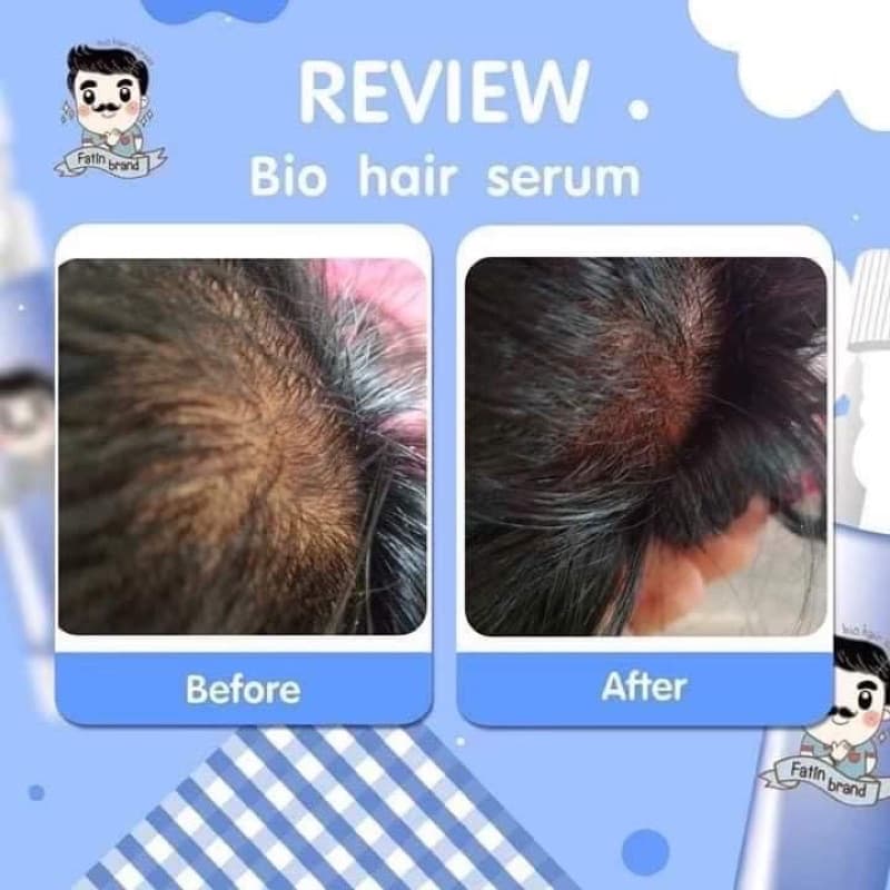 ไบโอฟาติน ปลูกคิ้ว ปลูกหนวด รูปที่ 2