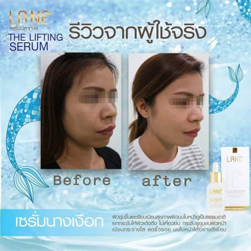 LANE’ เดอะลิฟติ้งเซรั่ม เซรั่มยกกระชับ ลดริ้วรอย สินค้าพรีเมี่ยม ขนาด 20 ml. รูปที่ 9