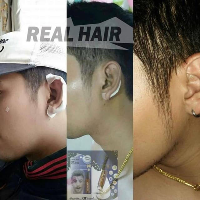 Real Hair- เซรั่มปลูกผม คิ้ว หนวด จอน - ใช้ได้ทั้ง ช ญ รูปที่ 7