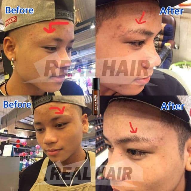 Real Hair- เซรั่มปลูกผม คิ้ว หนวด จอน - ใช้ได้ทั้ง ช ญ รูปที่ 6