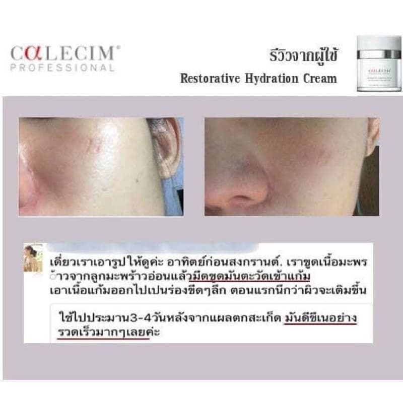 Calecim Growth Factors สารสกัดเซลล์ต้นกำเนิดของสายสะดือกวางแดง รูปที่ 8