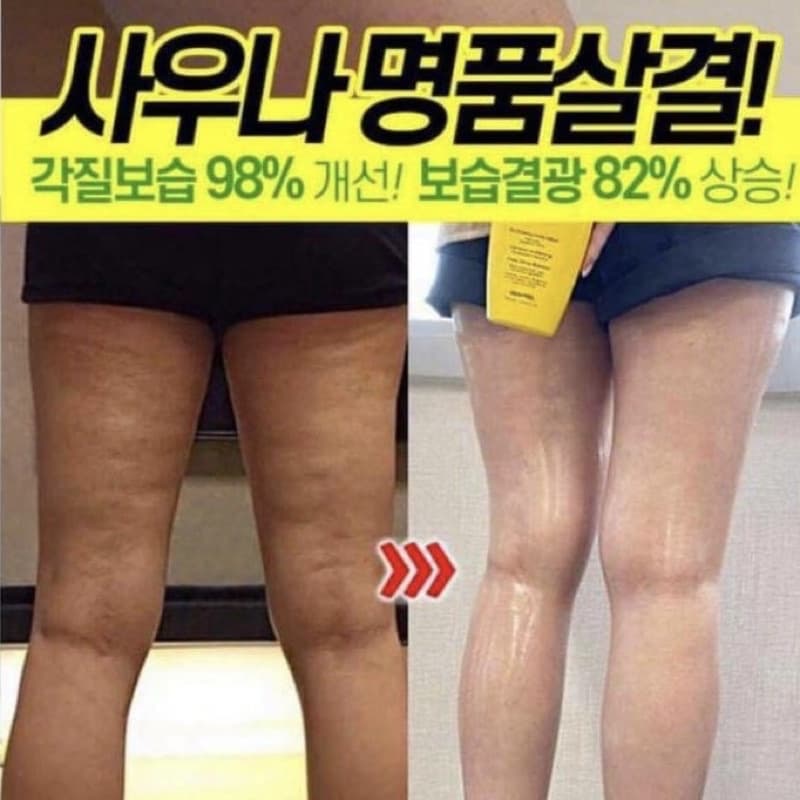 exp.2028โลชั่นลดสิว ผิวเปลือกส้ม Medi-Peel Vitamin Body Lotion รูปที่ 5