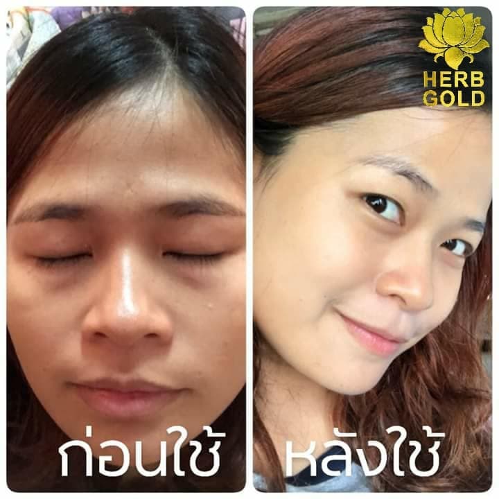 HERB Gold ครีมเฮิร์บ โกลด์ ชุด ครีม 30กรัม+ สบู่ 50 กรัม รูปที่ 3