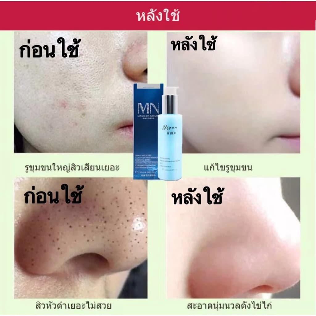 ภายใน7วัน รูขุมขนกระชับขึ้น รูขุมขนกระชับ เซรั่มหน้าใส น้ำตบกระชับรูขุมขน น้ำตบ เซรั่มหน้าใส บำรุงผิวหน้า ไวท์เทนนิ่ง เ รูปที่ 4