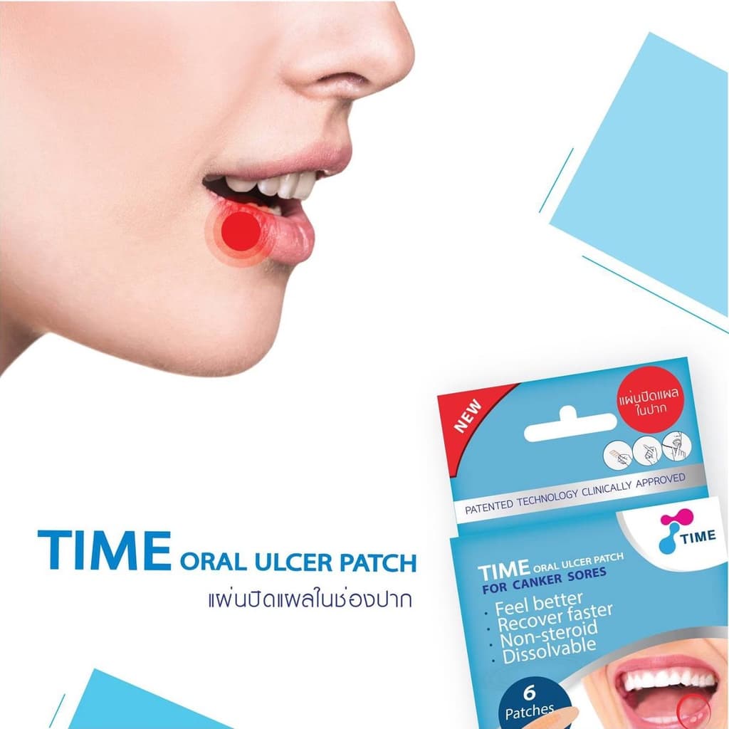 แผ่นแปะร้อนในแบบละลาย TIME ORAL ULCER PATCH ร้อนใน (แบบบรรจุ 4 ชิ้น และ รุ่นกล่อง บรรจุ 6 ชิ้น) รูปที่ 6