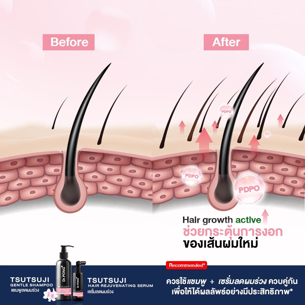 เซรั่มลดผมร่วง Dr.PONG TSUTSUJI HAIR REJUVENATING SERUM - anti-hairloss serum เซรั่มบำรุงผม ลดผมร่วง รูปที่ 5