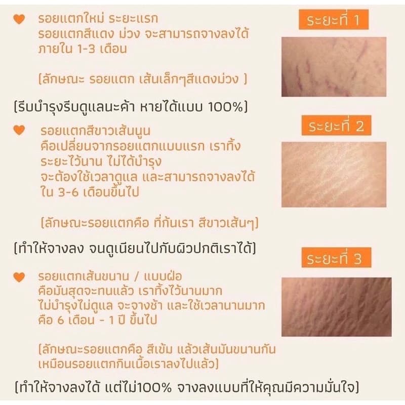 ของแท้ มีบัตรตท. ครีมทาก้น PWB แพ็คเกจใหม่ New ไม่ระบุชื่อสินค้า กุ้นลาย ผดสิ้วว รอยแตกลาย ดำด้าน รูปที่ 4