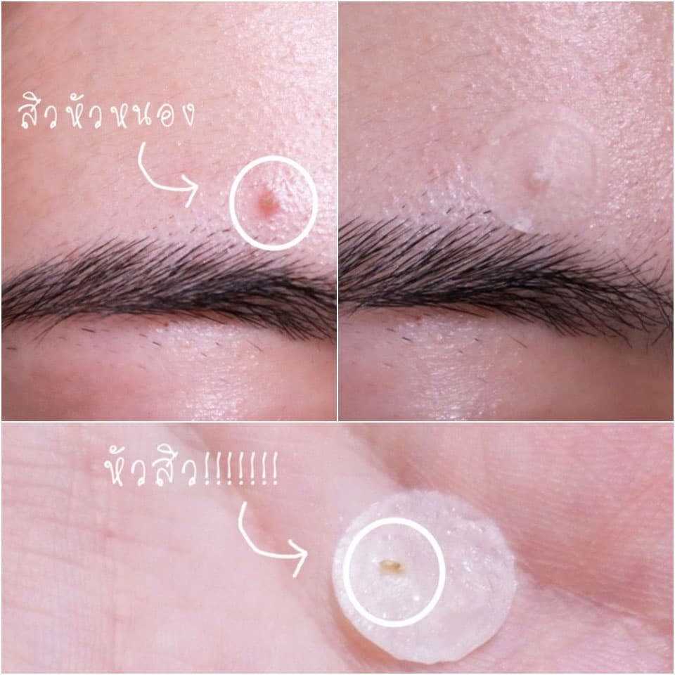 Duo DermaAngel Day 24 ชิ้น + กลางคืน 12 ชิ้น 2 กล่อง รูปที่ 5