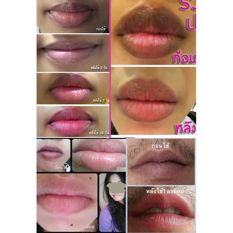 ครีมแก้ปากดำ ลิป ปากชมพู หลอดเขียวและม่วง สูตรเก่า เห็นผลไว เหมาะทุกสภาพผิว เดอร์ม่า พรรณ DERMA PAN รูปที่ 9