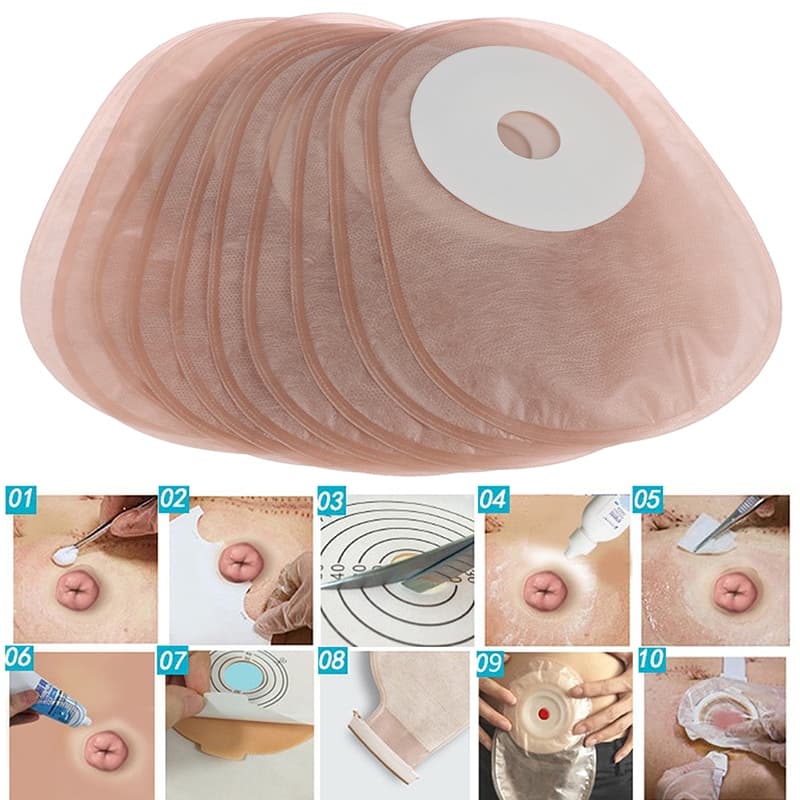 10PCS One-piece System Colostomy Bags Disposable Ostomy Drainable Single Pouch HDY รูปที่ 1