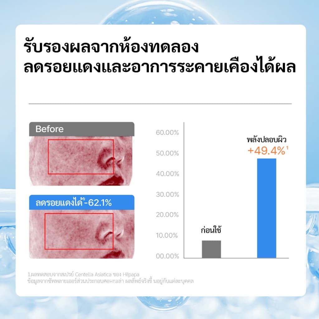 Hi!papa สเปรย์ใบบัวบก Centella Moisture Spray ลดรอยแดง ผิวแพ้ง่าย ใช้ได้ทุกวัน ปิด 31 ก.ค. รูปที่ 7