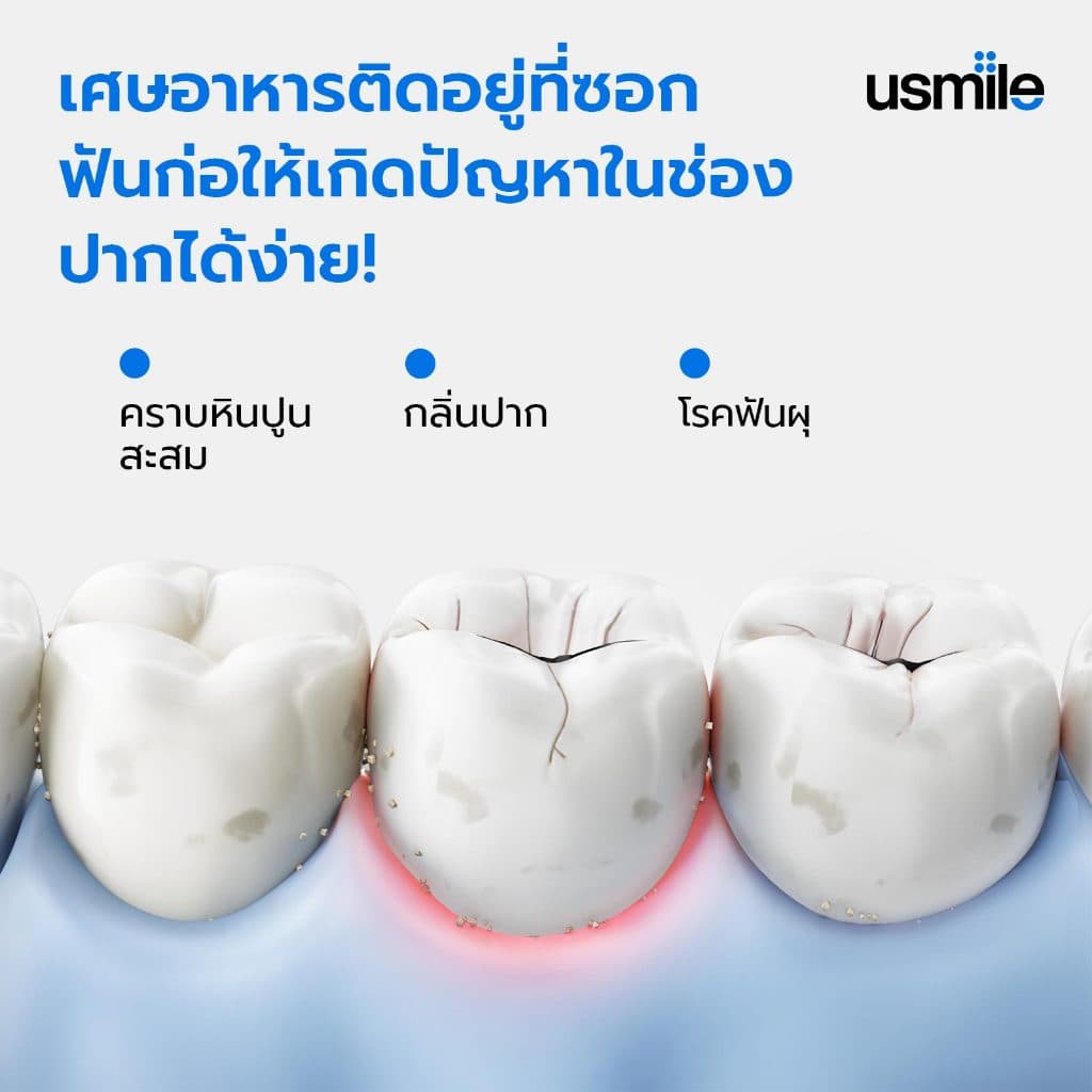usmile Floss Pick Twin-Line Tooth Clean Freshening ไหมขัดฟัน เส้นคู่ ปลอดภัยต่อเหงือก 18/50/200 ชิ้น รูปที่ 7