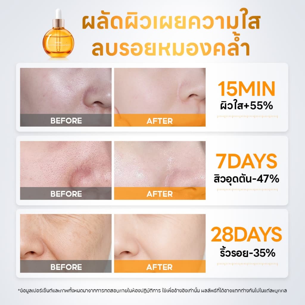 PAPA FEEL 0 Acid Peeling Serum เซรั่มเพื่อการ ผิวกระจ่างใส กระชับรูขุมขน ลดสิว PAPAIN BROMELAIN 8D Hyaluronic Acid essence 30ml รูปที่ 6