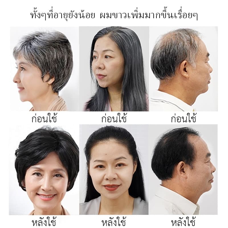 ของแท้Dr. jungle แชมพูผมหงอก แชมพู ลดผมหงอก ฟื้นฟูผมดำ แชมพูแก้ผมหงอก แชมพูผมดํา ผมขาวเป็นดำ แชมพูเฮ่อโส่วอู แชมพูเฮ่อโส่วอู แชมพูผมดำ แชมพูธรรมชาติจากรากโสมหลายดอก อ่อนโยนไม่ระคายเคือง ปกป้องหนังศีรษะ ช่วยให้ผมดกดำ 300ml รูปที่ 3