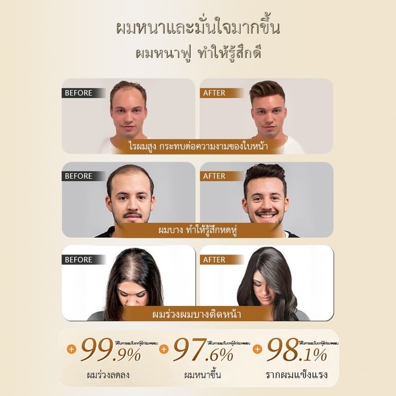 ของแท้Dr. jungle แชมพูผมหงอก แชมพู ลดผมหงอก ฟื้นฟูผมดำ แชมพูแก้ผมหงอก แชมพูผมดํา ผมขาวเป็นดำ แชมพูเฮ่อโส่วอู แชมพูเฮ่อโส่วอู แชมพูผมดำ แชมพูธรรมชาติจากรากโสมหลายดอก อ่อนโยนไม่ระคายเคือง ปกป้องหนังศีรษะ ช่วยให้ผมดกดำ 300ml รูปที่ 4