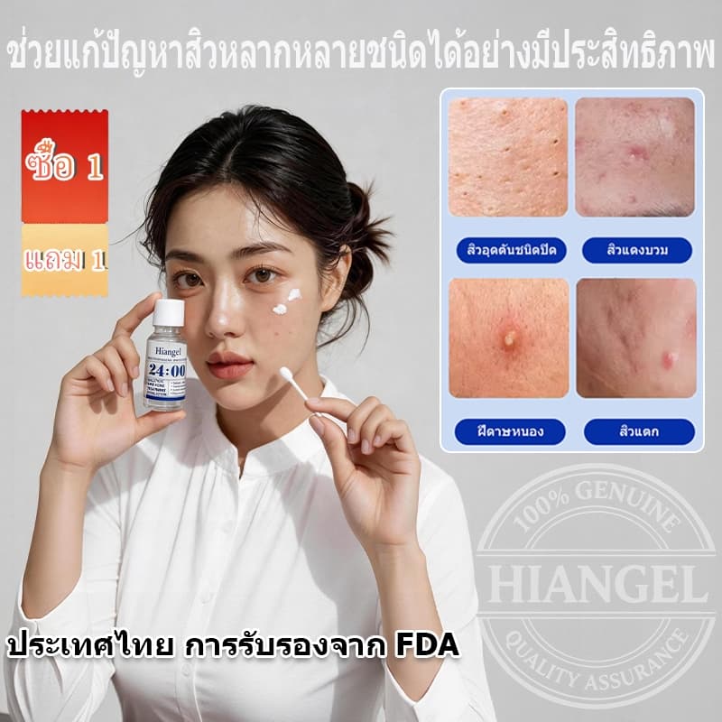 เอสเซนส์รักษาสิวไนอะซินาไมด์ กำจัดสิวได้อย่างมีประสิทธิภาพและรวดเร็ว บรรเทาอาการอักเสบ ลดรอยแผลเป็นจากสิว การควบคุมน้ำมัน การป้องกันการเกิดสิวซ้ำ Niacinamide Acne Treatment Serum Hiangel รูปที่ 1