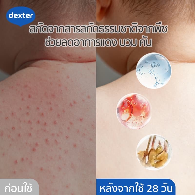 Dexter แป้งเด็กเหลว แบบโลชั่น ขมิ้น ดูดซับความชื้น ป้องกันผดผื่น คัน ให้ผิวลูกแห้งสบาย ไร้ฝุ่น แป้งเด็กเนื้อ + ครีมทาตัว รูปที่ 4