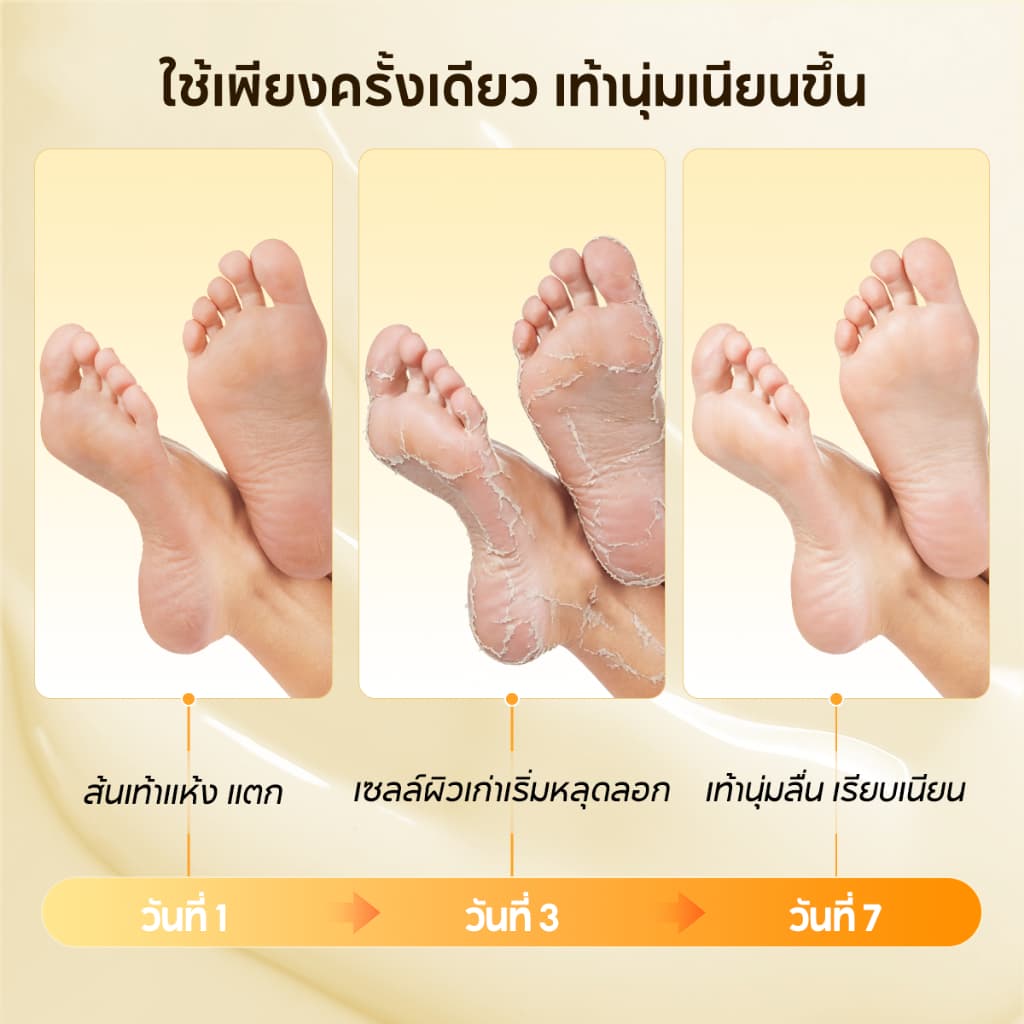 LANBENA Foot Peel Mask 3pairs/5pairs มาส์กขี้ผึ้งลอกเปลือกเท้า กำจัดผิวเก่า แห้งแล้ง ให้ผิวเนียนขาว หลายสูตร บำรุงเท้า รูปที่ 2