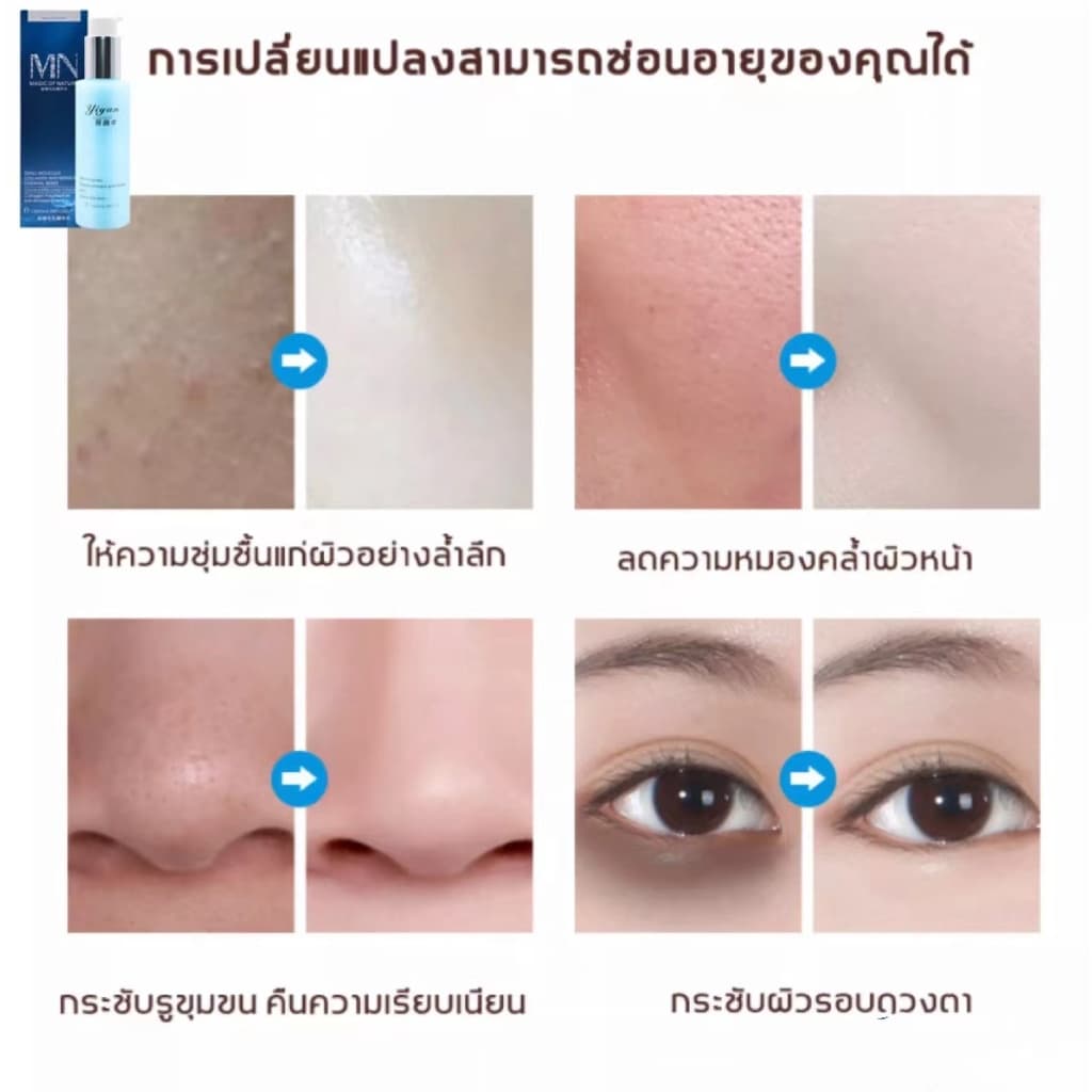 ภายใน7วัน รูขุมขนกระชับขึ้น รูขุมขนกระชับ เซรั่มหน้าใส น้ำตบกระชับรูขุมขน น้ำตบ เซรั่มหน้าใส บำรุงผิวหน้า ไวท์เทนนิ่ง เ รูปที่ 7