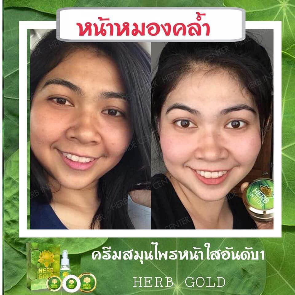 HERB Gold ครีมเฮิร์บ โกลด์ ชุด ครีม 30กรัม+ สบู่ 50 กรัม รูปที่ 5