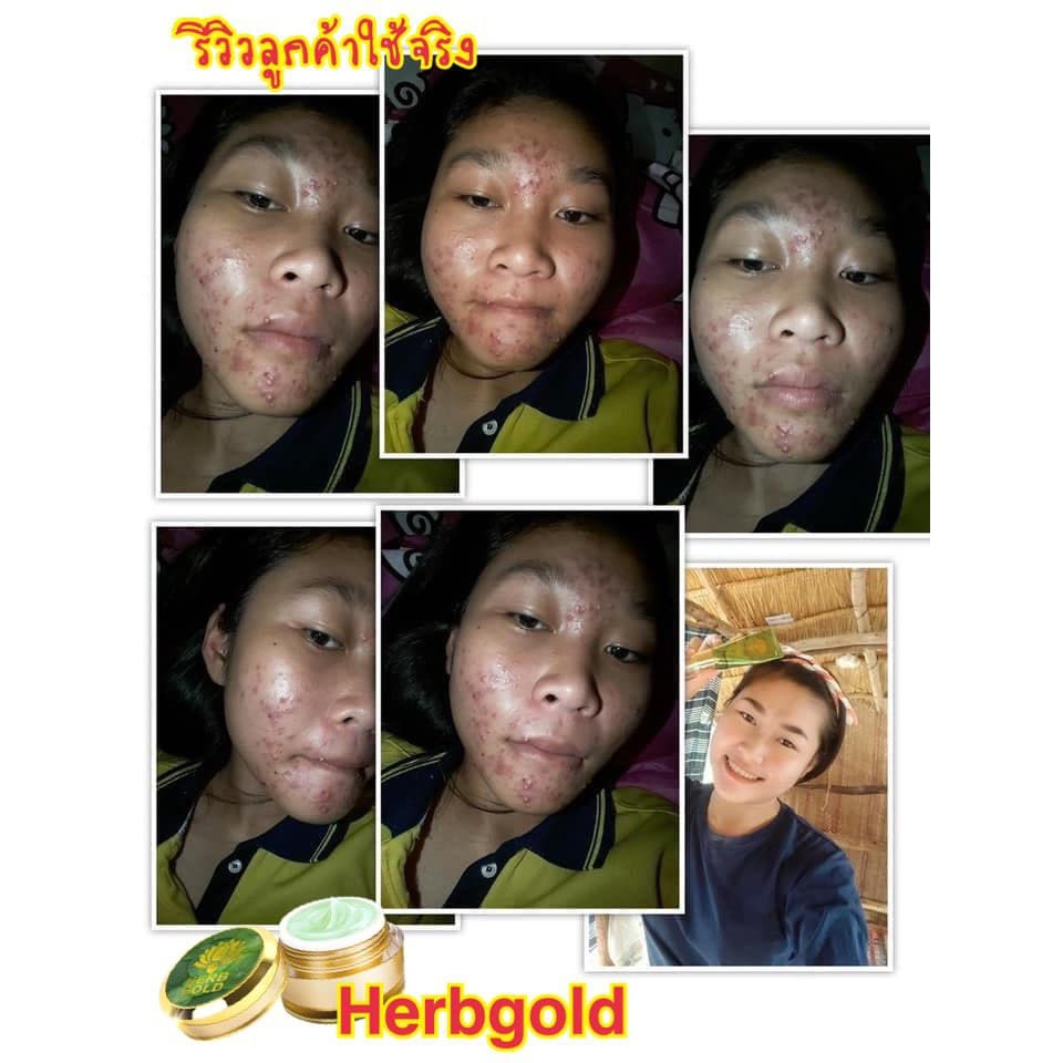 HERB Gold ครีมเฮิร์บ โกลด์ ชุด ครีม 30กรัม+ สบู่ 50 กรัม รูปที่ 6