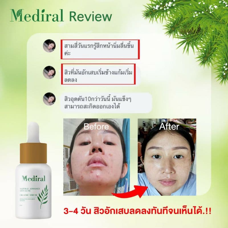 Mediral Organic Serum เวชสำอางค์ออร์แกนิคที่ผู้เชี่ยวชาญแนะนำ สารสกัดธรรมชาติ 24 ชนิดผิวแพ้ง่ายใช้ได้ดี รูปที่ 7