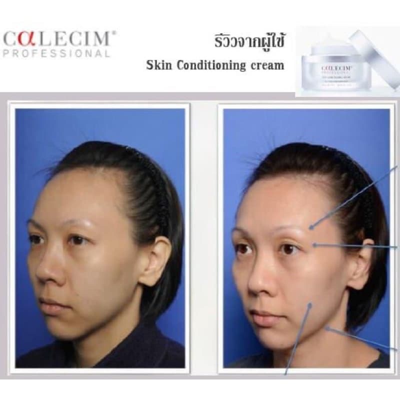 Calecim Growth Factors สารสกัดเซลล์ต้นกำเนิดของสายสะดือกวางแดง รูปที่ 6