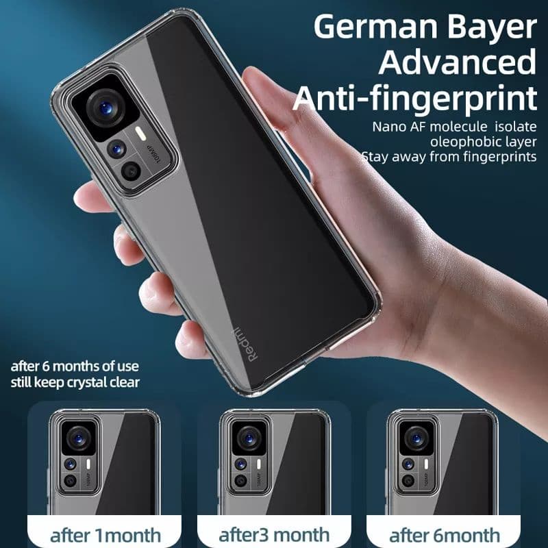 เคส for Xiaomi 17T Pro 15T Pro 17 ultra แม่เหล็ก case รูปที่ 5