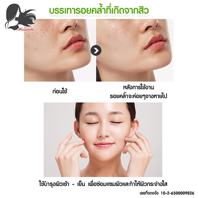 MISSNALA ESSENCE ALOE GEL เจลบำรุงผิว บำรุงผิวและซ่อมแซมผิว จากปัญหาสิว สารสกัดจากว่านหางจระเข้ 99% รูปที่ 8