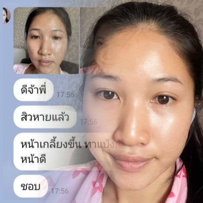 #ครีมบูเต้ไวท์&บริ้งไวท์ลดสิวฝ้าเห็นผลจริงใน7วัน รูปที่ 6