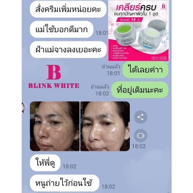 #ครีมบูเต้ไวท์&บริ้งไวท์ลดสิวฝ้าเห็นผลจริงใน7วัน รูปที่ 8