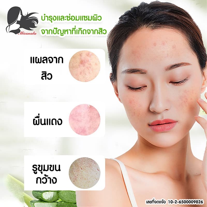 MISSNALA ESSENCE ALOE GEL เจลบำรุงผิว บำรุงผิวและซ่อมแซมผิว จากปัญหาสิว สารสกัดจากว่านหางจระเข้ 99% รูปที่ 3