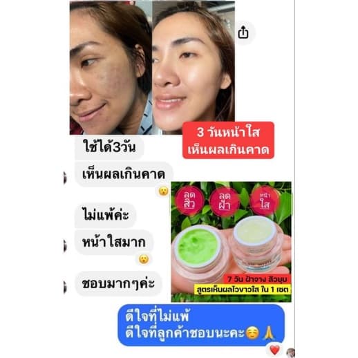 #ครีมบูเต้ไวท์&บริ้งไวท์ลดสิวฝ้าเห็นผลจริงใน7วัน รูปที่ 9