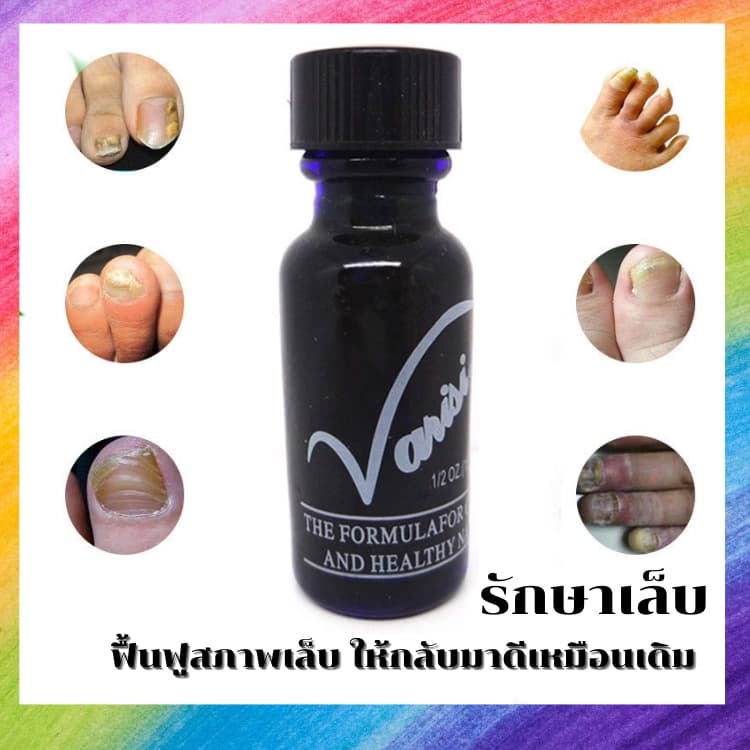 ฆ่าเชื้อราที่เล็บ เซรั่ม รักษาเล็บ ซ่อมเล็บที่ชำรุด เชื้อราในเล็บ บำรุงเล็บ ที่เสีย รูปที่ 1