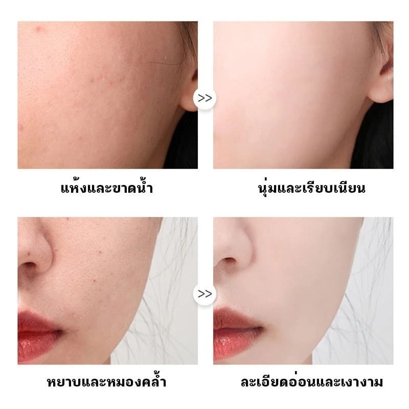 มาร์คแผ่นเซรั่มเปปไทด์โอลิโกหน้าฉ่ำ หน้าเงา ผิวหน้านุ่มชุ่มชื่น OLIGOPEPTIDE มาส์กเปปไทด์สูตรพรีเมี่ยม รูปที่ 6