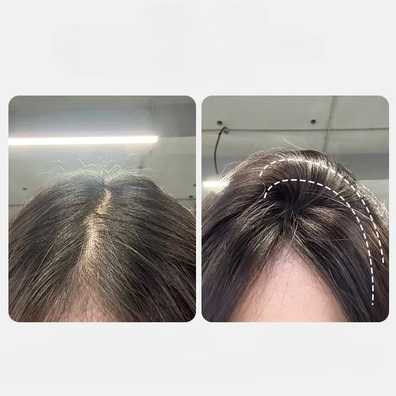 High Head Top Artifact หวีรากผมธรรมชาติปุยขี้เกียจ Traceless กิ๊บติดผมผม Fluffy Shaping Artifact รูปที่ 7
